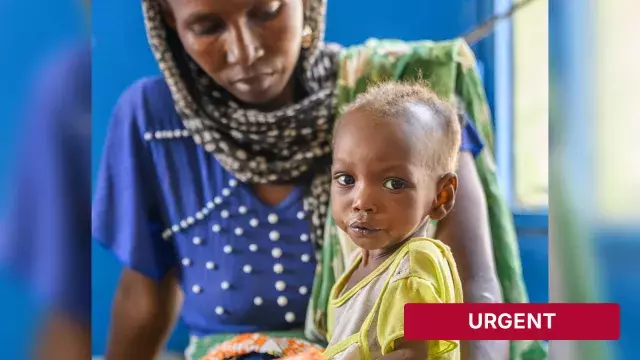 Adult holding malnourished child with urgent label